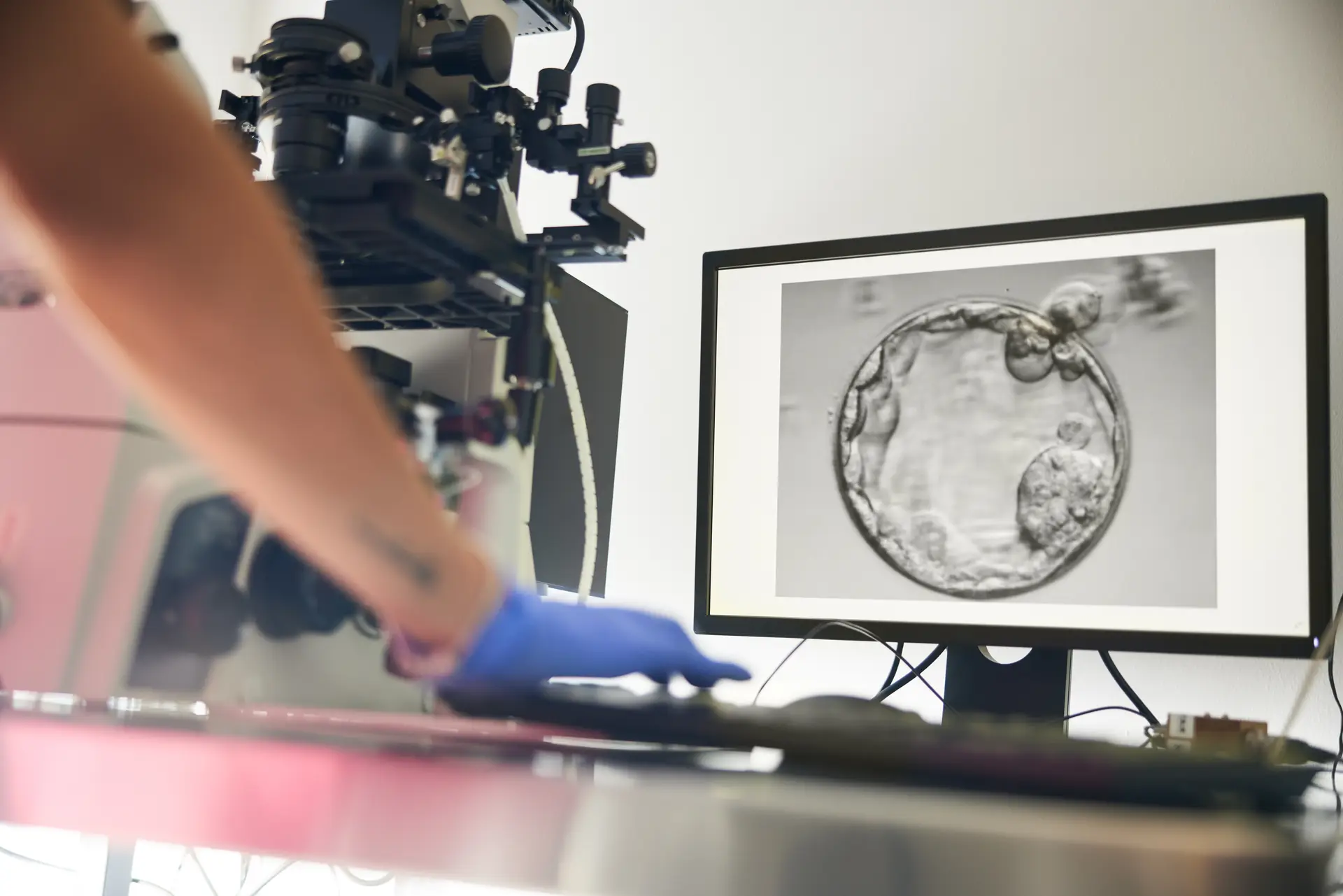 AI-assisted embryology assessment